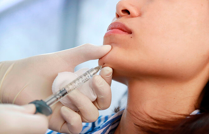 Как быстро убрать второй подбородок: все возможные способы