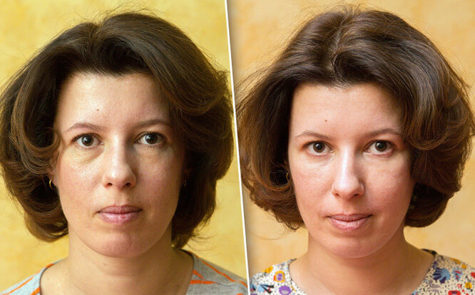 Как избавиться от мешков под глазами навсегда: лучшие способы