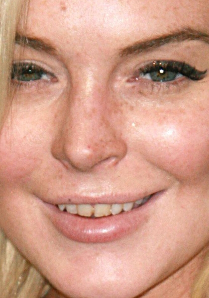 Как улыбка влияет на успех? 10 звезд, которые «поработали» над своими зубами