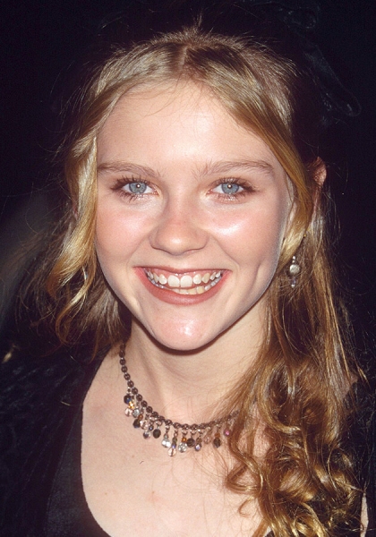 Как улыбка влияет на успех? 10 звезд, которые «поработали» над своими зубами