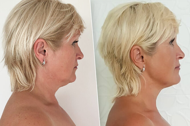 Личный опыт: как фейс-гимнастика изменила не только внешность, но и всю жизнь