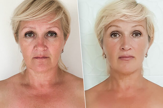 Личный опыт: как фейс-гимнастика изменила не только внешность, но и всю жизнь