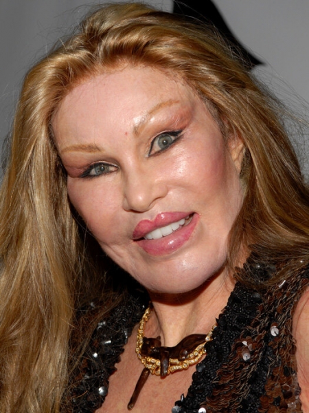 Миллион за красоту: самые дорогие пластические операции звезд