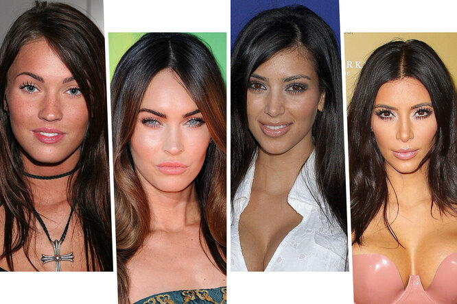 Миллион за красоту: самые дорогие пластические операции звезд