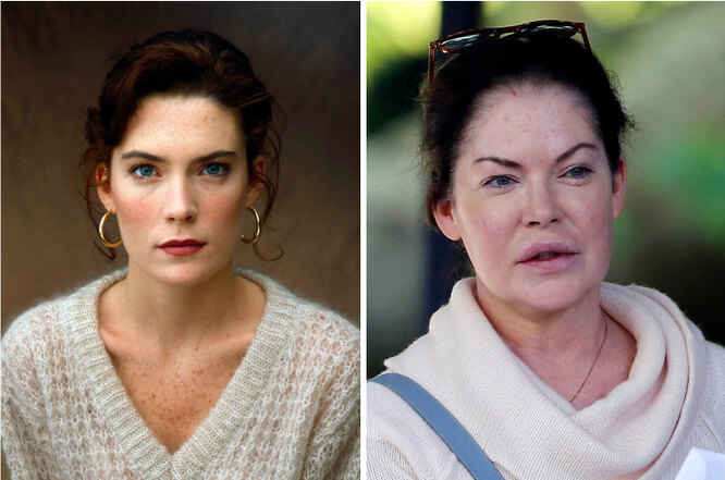 Наливные яблочки: звёзды, которые перестарались с&nbsp;увеличением впалых щёк