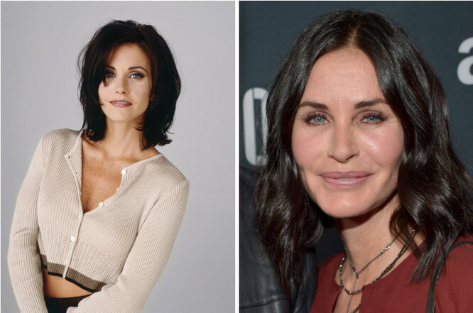 Наливные яблочки: звёзды, которые перестарались с&nbsp;увеличением впалых щёк