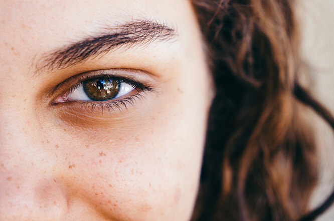 Опасно или нет: инъекции, убирающие синяки под глазами, — мнение косметологов