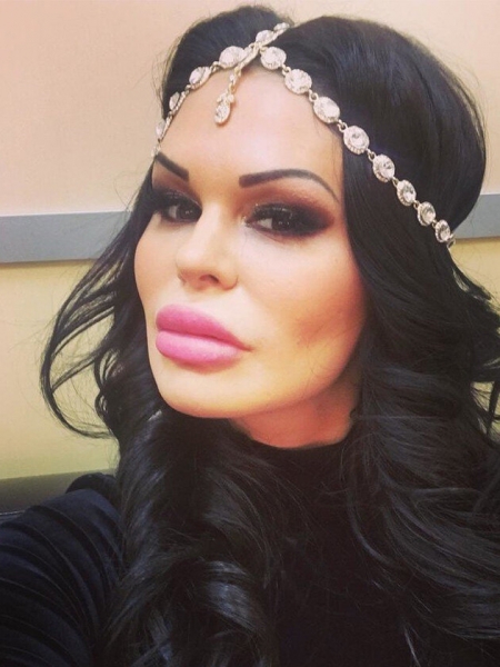 Рот на пол-лица: звезды, которые переборщили с инъекциями в губы