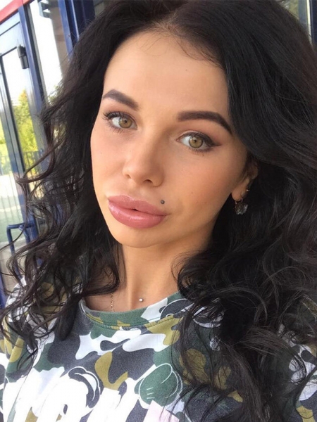 Рот на пол-лица: звезды, которые переборщили с инъекциями в губы