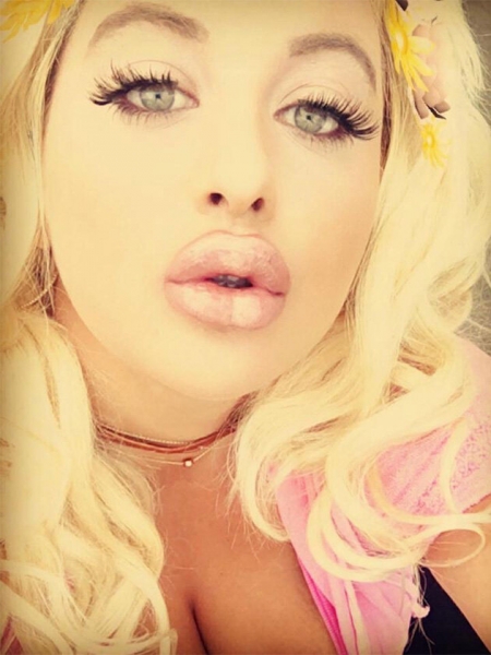 Рот на пол-лица: звезды, которые переборщили с инъекциями в губы