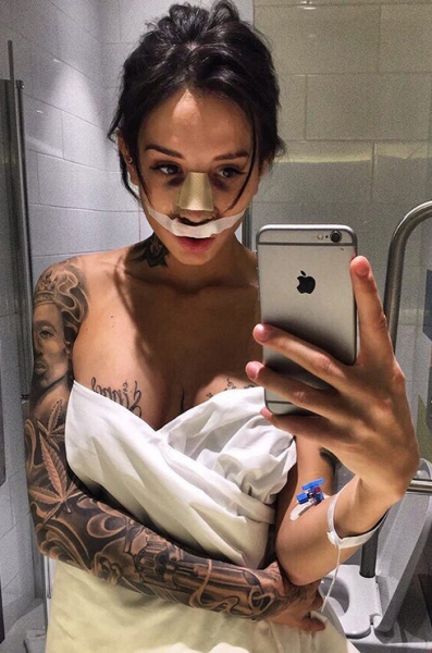 Самые странные пластические операции участников «Дома-2»