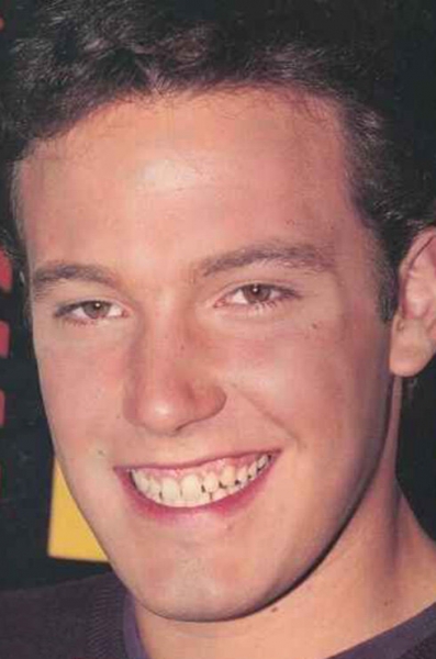 Улыбка на&nbsp;миллион: сколько заплатили звезды за&nbsp;свои идеальные зубы