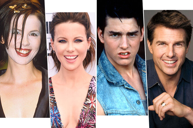 Улыбка на&nbsp;миллион: сколько заплатили звезды за&nbsp;свои идеальные зубы