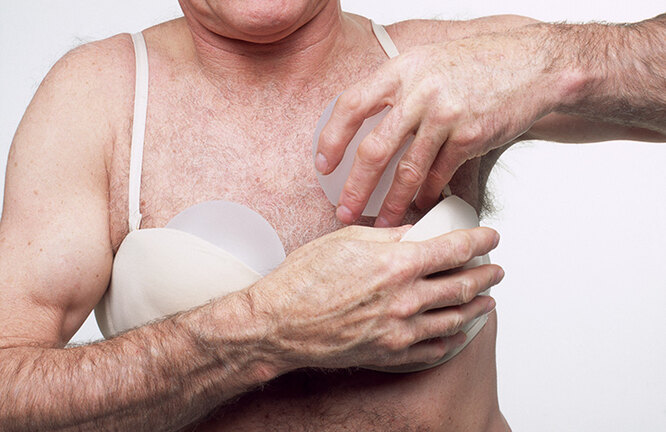 Уши эльфа и пупок-вагина — самые странные запросы к пластическому хирургу