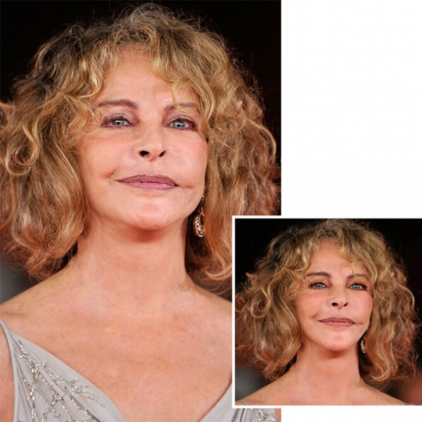 Верните как было! Как бы выглядели звезды, если бы не изуродовали себя пластикой