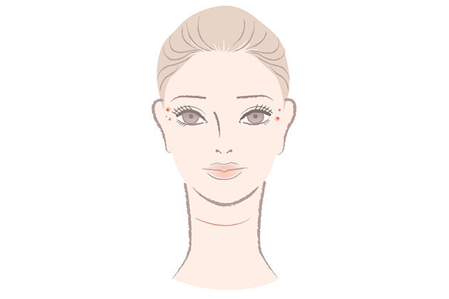 Высыпания на разных участках лица: о чем они говорят?