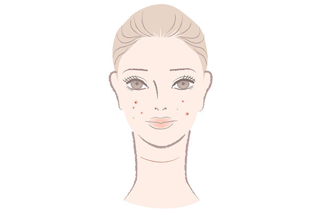 Высыпания на разных участках лица: о чем они говорят?