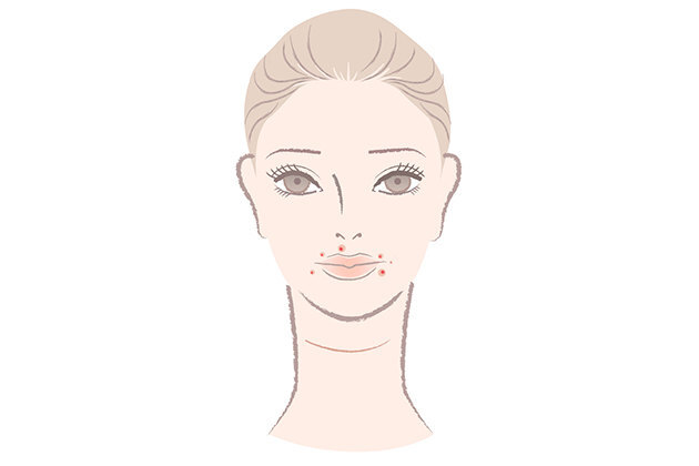 Высыпания на разных участках лица: о чем они говорят?