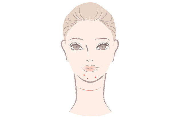 Высыпания на разных участках лица: о чем они говорят?