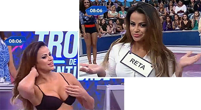 Жертвы красоты: звезды, которых убила неудачная пластика