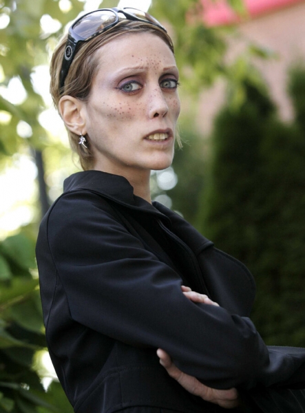 Звезды, которым худоба стоила жизни — 10 реальных историй