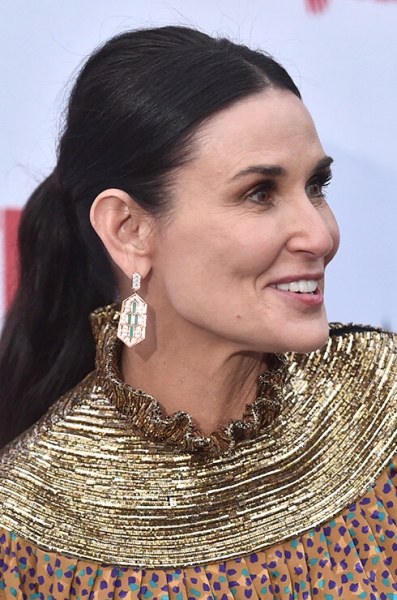 Звезды с пластикой шеи: кто из знаменитостей выглядит моложе после операции