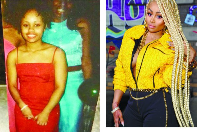 Звёзды до и после пластики - ТОП-10 фото на PEOPLETALK