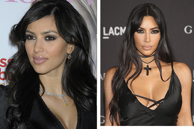 Звёзды до и после пластики - ТОП-10 фото на PEOPLETALK