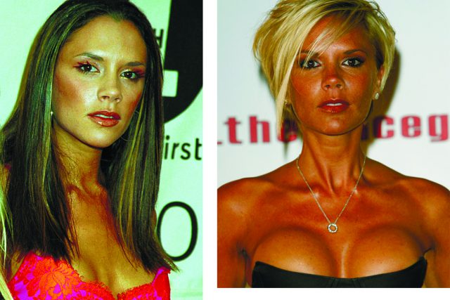 Звёзды до и после пластики - ТОП-10 фото на PEOPLETALK