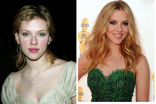 Звёзды до и после пластики - ТОП-10 фото на PEOPLETALK