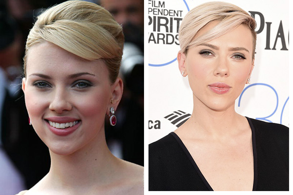 Звёзды до и после пластики - ТОП-10 фото на PEOPLETALK