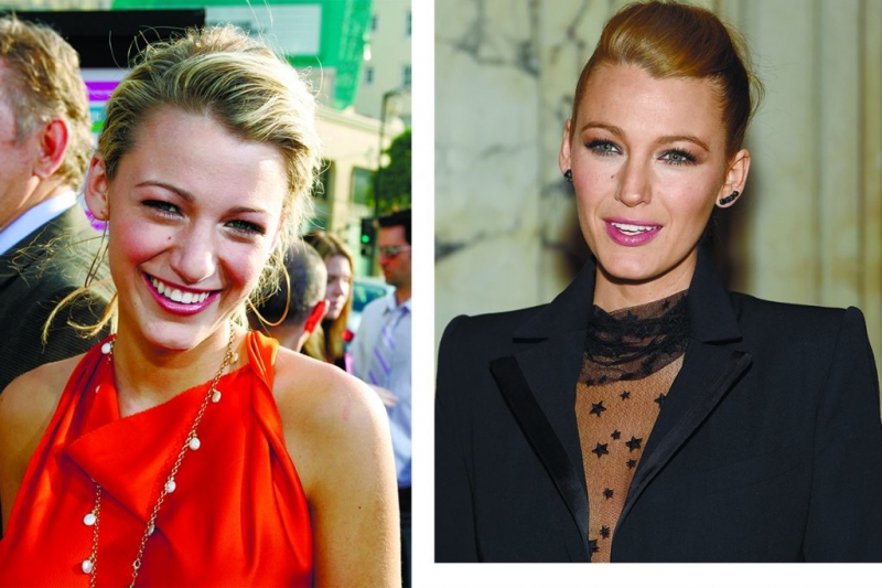 Звёзды до и после пластики - ТОП-10 фото на PEOPLETALK