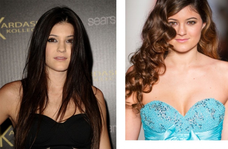 Звёзды до и после пластики - ТОП-10 фото на PEOPLETALK