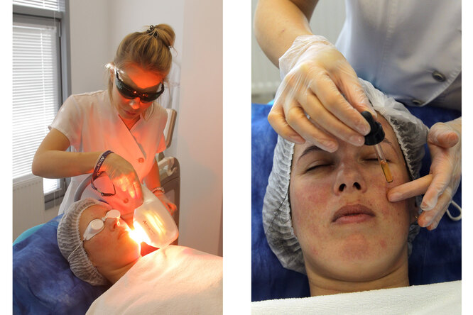 Фотоомоложение лица:  ответы на&nbsp;все вопросы, результаты и&nbsp;личный опыт редактора