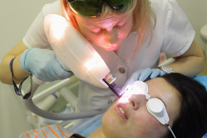 Фотоомоложение лица:  ответы на&nbsp;все вопросы, результаты и&nbsp;личный опыт редактора