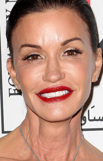 Красота в прошлом? Модели, которые испортили свою внешность пластикой