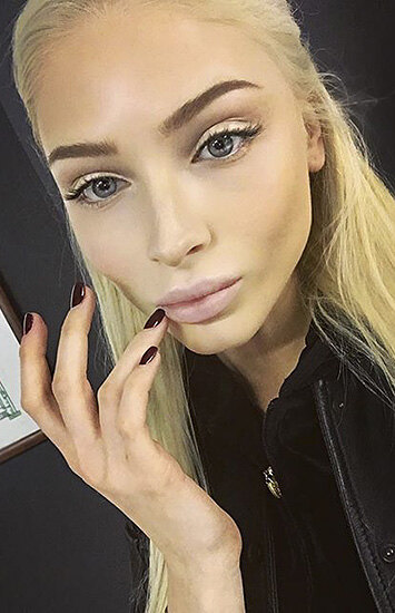 Красота в прошлом? Модели, которые испортили свою внешность пластикой