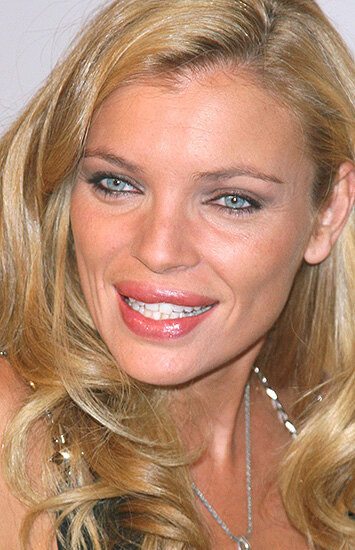 Красота в прошлом? Модели, которые испортили свою внешность пластикой