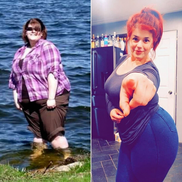 Лучше не стало! Как выглядят тела женщин, похудевших на 50, 100 и даже 150 кг
