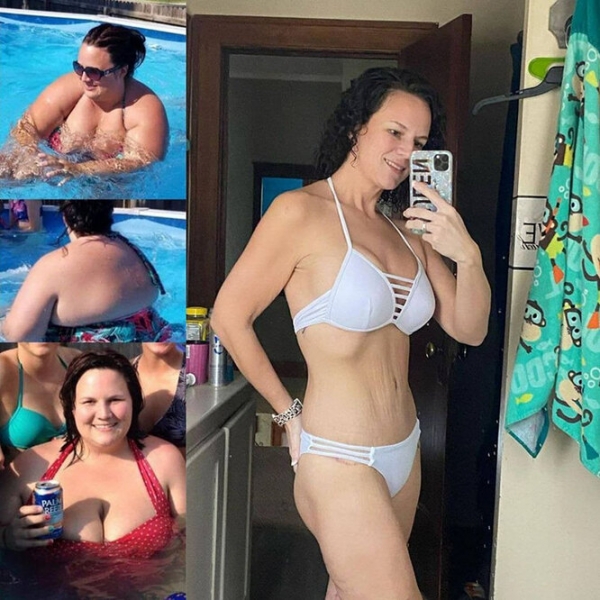 Лучше не стало! Как выглядят тела женщин, похудевших на 50, 100 и даже 150 кг