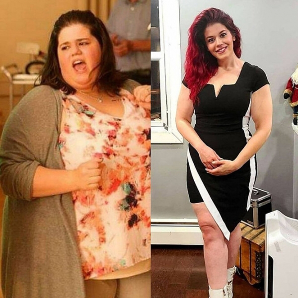 Лучше не стало! Как выглядят тела женщин, похудевших на 50, 100 и даже 150 кг