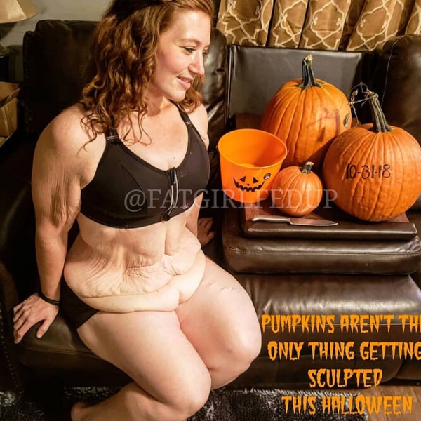 Лучше не стало! Как выглядят тела женщин, похудевших на 50, 100 и даже 150 кг