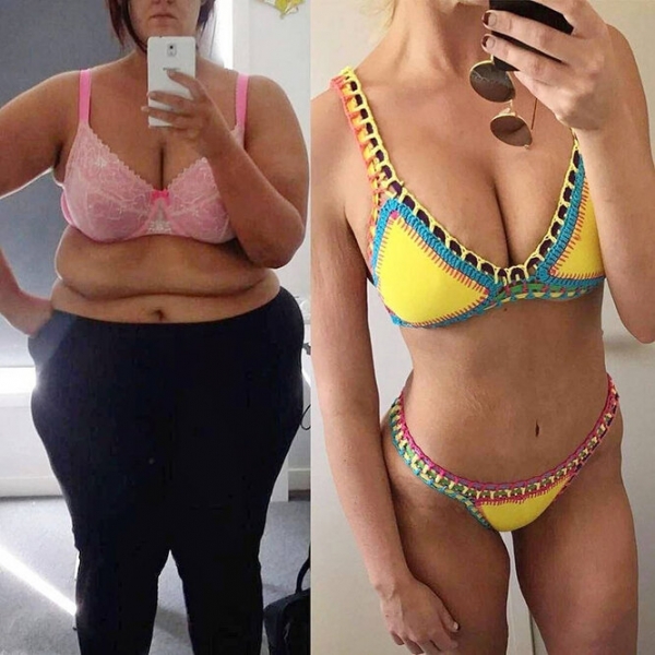 Лучше не стало! Как выглядят тела женщин, похудевших на 50, 100 и даже 150 кг