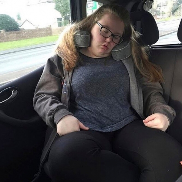 Лучше не стало! Как выглядят тела женщин, похудевших на 50, 100 и даже 150 кг