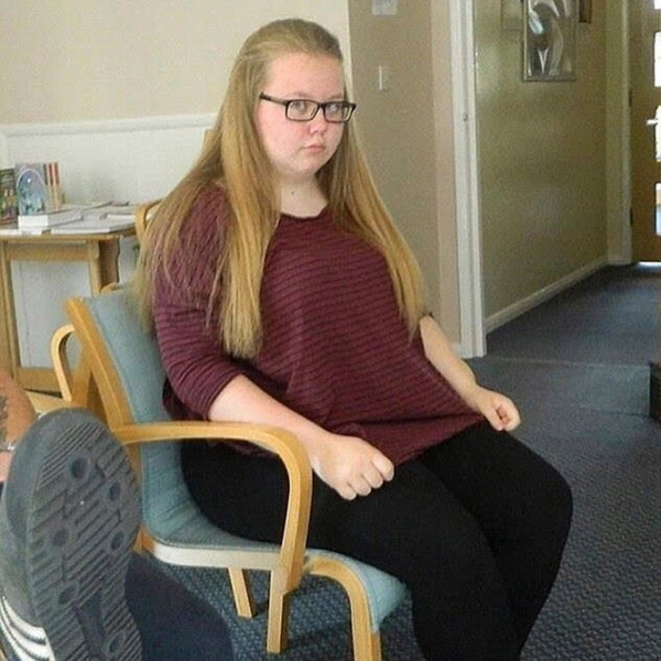 Лучше не стало! Как выглядят тела женщин, похудевших на 50, 100 и даже 150 кг