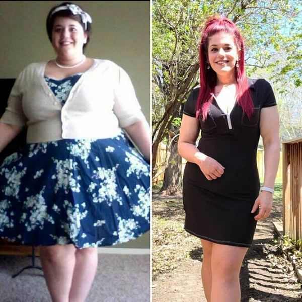 Лучше не стало! Как выглядят тела женщин, похудевших на 50, 100 и даже 150 кг
