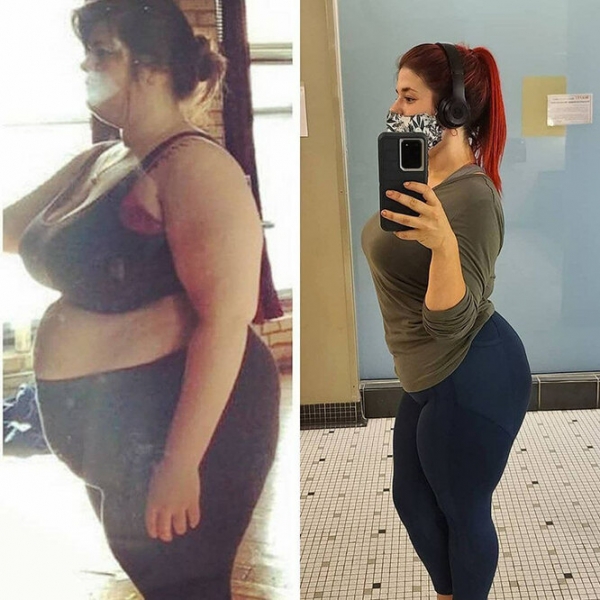 Лучше не стало! Как выглядят тела женщин, похудевших на 50, 100 и даже 150 кг