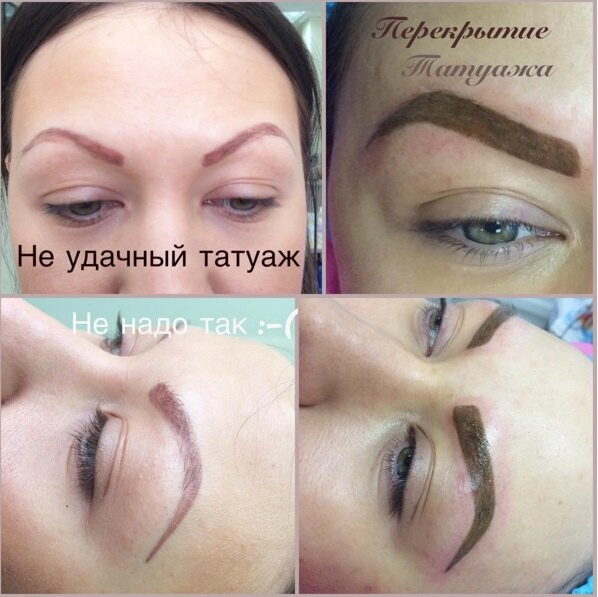 «Ниточки» и «угольки»: неудачный татуаж бровей — фото до и после