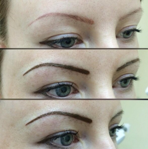 «Ниточки» и «угольки»: неудачный татуаж бровей — фото до и после