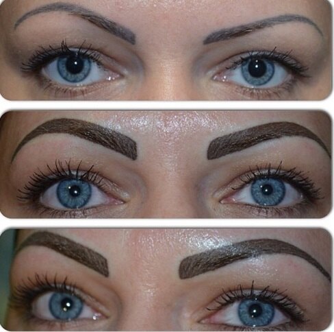 «Ниточки» и «угольки»: неудачный татуаж бровей — фото до и после